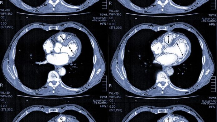 How Cardiologists Use Imaging To Diagnose Heart Disease