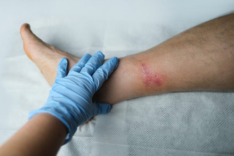 Wound Isn't Healing Properly