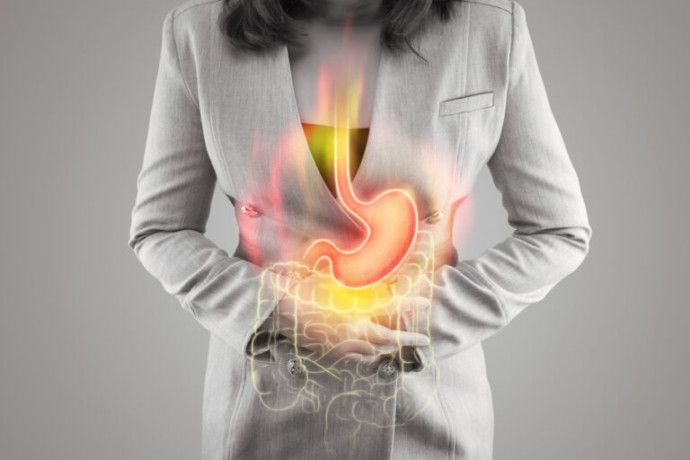 Managing Acid Reflux